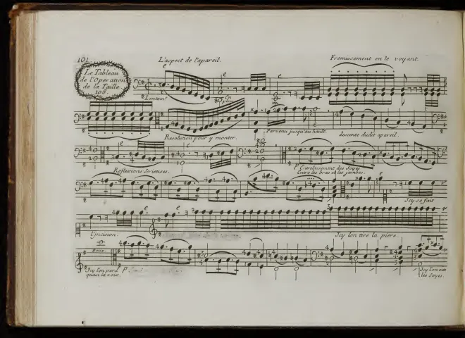 First page of Le Tableau de l'Operation de la Taille